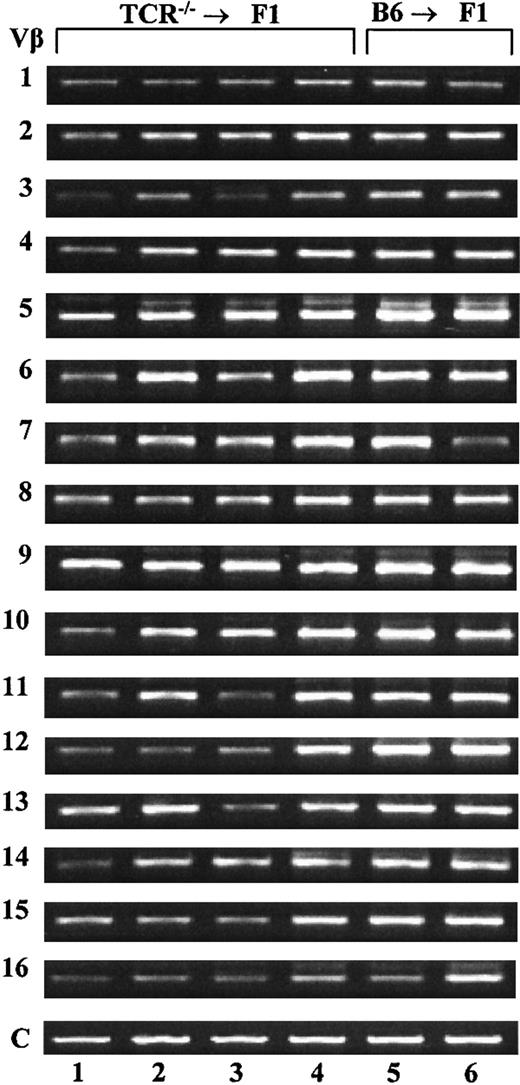 Figure 5. Host T cells in TCR–/– → F1 bone marrow chimeras represent a polyclonal population. RT-PCR amplification was performed on total RNA extracted from the spleens of TCR—/— → F1 and B6 → F1 chimeras. Lanes 1 to 4 represent results for 4 individual TCR—/— → F1 mice and lanes 5 to 6 are amplification products for 2 individual B6 → F1 mice. Amplification products for Vβ families 1 to 16 are shown. As a control, primers for constant regions of Vβ were used and are denoted as “C.” Results are representative of 2 independent experiments.