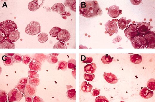 Figure 5. Morphologic analysis of phagocytosis of IgG-coated sheep RBCs. Transfectants of WT G-CSF-R (A-B) or the truncated G-CSF-R MT (C-D) were incubated for 30 minutes with IgG-coated sheep RBCs in the presence (B,D) or in the absence (A,C) of G-CSF, 300 ng/mL. Stained with May-Grünwald-Giemsa. Original magnification, × 100.