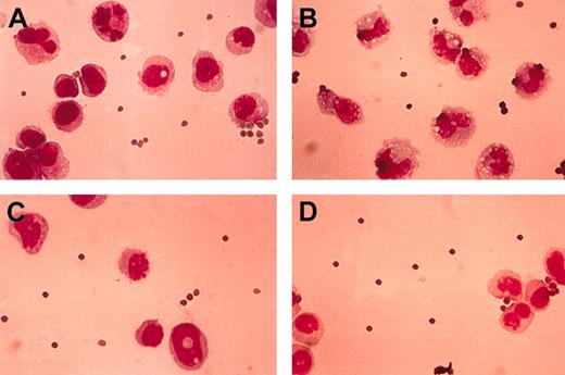 Figure 6. Morphologic analysis of phagocytosis of IgG-coated sheep RBCs after maturation of 32D cells induced by G-CSF. Transfectants of WT G-CSF-R (A-B) or the truncated G-CSF-R mutant (C-D) were incubated for 30 minutes with IgG-coated sheep RBCs in the presence (B,D) or in the absence (A,C) of G-CSF, 300 ng/mL, after incubation for 3 days with G-CSF, 100 ng/mL, performed to obtain partial granulocytic maturation. Stained with May-Grünwald-Giemsa. Original magnification, × 100.
