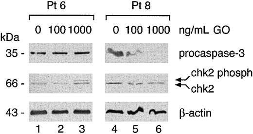 Figure 10. Chk2 and caspase 3 activation in freshly isolated AML samples. Cells isolated from the indicated patients were cultured for 48 hours with 100 to 1000 ng/mL GO. Cytoplasmic extracts (60 μg) were analyzed in Western blot with the indicated antibodies.