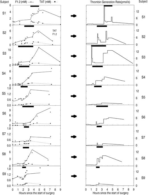 Figure 6. Estimated thrombin generation rate in 9 subjects during cardiopulmonary bypass (CPB) surgery using both F1.2 and thrombin-antithrombin (TAT) levels. The left column of graphs shows the measured levels (•, F1.2; ▴, TAT) and circulatory model predicted levels (solid line, F1.2; dotted line, TAT) of each activation marker. Note variable scale of the y axis. The right column of graphs shows the resulting predicted thrombin generation rate from the circulatory model using both markers simultaneously. The y-axis is the same for all subjects showing noticeable variations in response to CPB among the 9 subjects. The solid black box at the top of each graph indicates the period of cardiopulmonary bypass.