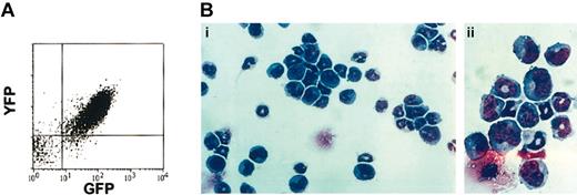Figure 5. Diseased mice that received transplanted BM cotransduced with ND13 and Meis1 died of AML. (A) Analysis of YFP and GFP expression in leukemic marrow cells. (B) Wright-Giemsa staining of ND13-Meis1 BM cells. Original magnification, × 32 (i); × 80 (ii).