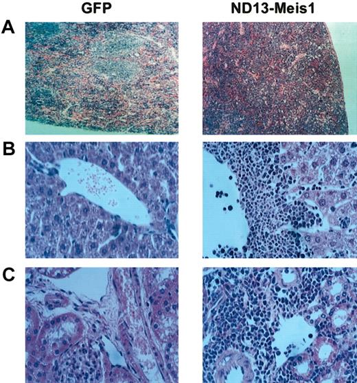 Figure 7. Diseased ND13-Meis1 mice are characterized by massive perivascular infiltration of leukemic myeloblastic cells. (A) Histologic analysis of spleen (original magnification, × 10). (B) Histologic analysis of liver (original magnification, × 32). (C) Histologic analysis of kidneys (original magnification, × 32).
