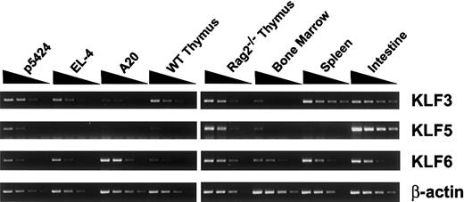 Figure 7. Klf3, Klf5, and Klf6 mRNA expression in lymphoid cells. Total RNA from p5424 pro-T, EL-4 mature T, A20 B-cell lines, and primary mouse tissues, including wild-type and RAG-2–deficient thymus, spleen, bone marrow, and intestine, were serially diluted (1:5:25:125) and amplified by RT-PCR using specific primer pairs under optimal conditions with β-actin as a control.