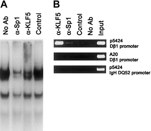 Figure 8. KLF5 binds Dβ1 promoter in vitro and in vivo. (A) KLF5 and Sp1 are among nuclear proteins in pro-T cells binding the -35 motif in the Dβ1 promoter. Nuclear extracts from p5424 cells were incubated with no antibody, anti-Sp1 antiserum, anti-KLF5 antiserum, or control antiserum at room temperature for 20 minutes before EMSA. (B) KLF5 binds the Dβ1 promoter in p5424 cells in vivo. p5424 and A20 cells were cross-linked by 1% formaldehyde, sonicated, and subjected to chromatin immunoprecipitation assay with anti-KLF5 antiserum, anti-Sp1 antiserum, control antiserum, or without antibody. Immunoprecipitates were assayed for Dβ1 or IgH DQ52 promoter sequences using nested PCR.