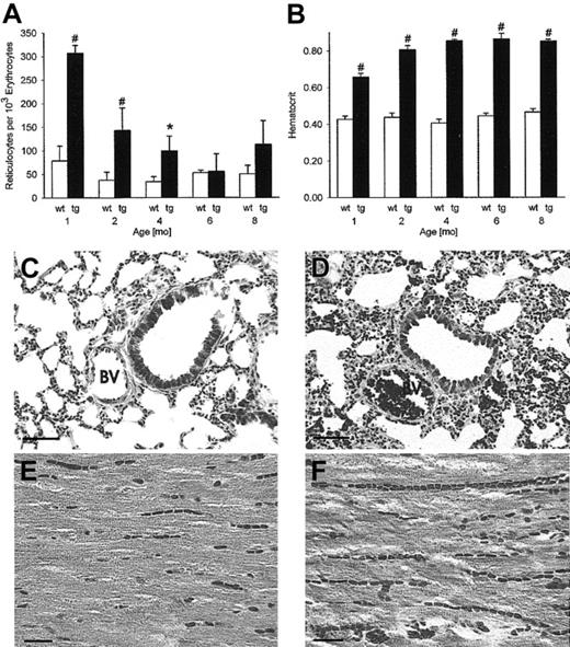 Figure 1. Lack of histologic evidence of thrombosis or emboli in any organ despite a hematocrit value of 0.85. Reticulocyte numbers (A) were increased in erythropoietin transgenic mice, most prominently in the first 4 months (n = 5 per group). Time course of the hematocrit value (B) shows a plateau of 0.85 from 2 months onward in transgenic mice (n = 30 per group). BV indicates bronchial vein; wt, wild-type; tg, transgenic. *P < .01, #P < .001, compared with age-matched wild-type controls. Tissue sections from the lung and the heart of 8-month-old mice (C,E, wild-type mice; D,F, transgenic mice) demonstrate the plethora of erythrocytes in the vasculature of transgenic mice without signs of thrombosis or emboli. Original magnification, × 200 for panels C and D, trichrome, scale bar 50 μm. Original magnification, × 400 for panels E and F, hematoxylin and eosin, scale bar 20 μm.