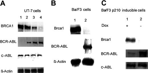 Figure 1. Western blot analysis showing BRCA1 and BCR-ABL expression in human and murine clones expressing variable levels of BCR-ABL. (A) Levels of BRCA1 and BCR-ABL protein were analyzed by immunoblotting 50 μg whole-cell extracts of UT-7 cell clones (lane 1, UT-7/P; lane 2, UT-7/E8-1; lane 3, UT-7/E8-2; lane 4, UT-7/9). (B) Levels of Brca1 and BCR-ABL protein were analyzed by immunoblotting 50 μg whole-cell extracts of murine Ba/F3 clones (lane 1, Ba/F3; lane 2, Ba/F3 210). (C) Levels of Brca1 and BCR-ABL protein were analyzed by immunoblotting 50 μg whole-cell extracts of Tetoff conditional cell line (lane 1, cells exposed to doxycycline; lane 2, no exposure of cells to doxycycline).