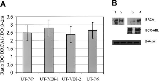 Figure 4. Expression of BRCA1 mRNA and Western blot analysis. (A) Relative expression of BRCA1 mRNA in UT-7 cell clones expressing different levels of BCR-ABL. Mean levels of expression of the BRCA1 gene, normalized to β-2 microglobulin gene, are displayed logarithmically on the y-axis. For clarity, only positive error bars (SD) are shown. For all categories, n = 3. (B) Western blot analysis showing the effects of proteasome inhibitor in UT-7 cell clones. Parental UT-7/P and BCR-ABL–expressing UT-7/9 cells were grown in recombinant human granulocyte macrophage colony-stimulating factor (rhGM-CSF) and exposed to proteasome inhibitor lactacystin 5 μM diluted in DMSO; similar volume of DMSO was added for 8 hours as a control. Whole-cell extracts were subjected to Western blot analysis using anti-BRCA1, anti–c-ABL (lane 1, UT-7/P + DMSO; lane 2, UT-7/P + lactacystin; lane 3, UT-7/9 + DMSO; lane 4, UT-7/9 + lactacystin).