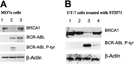 Figure 5. Western blot analyses. (A) Western blot analysis showing BRCA1 and BCR-ABL expression in different MO7e cells. Cell extracts (50 μg) were subjected to Western blot analysis using anti-BRCA1, anti–c-ABL, and antiphosphotyrosine (lane 1, MO7e MIGR EGFP; lane 2, MO7e MIGR BCR-ABL-IRES-eGFP; lane 3, MO7e MIGR BCR-ABL/1172-IRES-eGFP). (B) Western blot analysis showing the effects of STI571 (C-ABL tyrosine kinase inhibitor) in UT-7 cell clones. Parental UT-7/P and BCR-ABL–expressing UT-7/9 cells were grown in rhGM-CSF and exposed to STI571 5 μM for 24 hours. Whole-cell extracts were subjected to Western blot analysis using anti-BRCA1, anti–c-ABL, antiphosphotyrosine, and anti–β-actin (lane 1, UT-7/P control; lane 2, UT-7/P + STI571; lane 3, UT-7/9 control; lane 4, UT-7/9 + STI571).