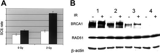 Figure 6. SCE and BRCA1 and RAD51 accumulation. (A) Sister chromatid exchange rate in parental (UT-7/P, □) and BCR-ABL–expressing cells (UT-7/9, ▪). Cells were pulsed with 5′Brdu for 24 hours and dropped on slides after hypotonic shock. SCE was revealed by Hoechst 33528 staining. The SCE rate was expressed as the average of the number of exchanged chromatid adjusted to the individual cell ploidy; error bars show 5% confidence intervals. (B) BRCA1 and RAD51 accumulation in UT-7 cell clones expressing variable levels of BCR-ABL. UT-7 clones expressing different levels of BCR-ABL were irradiated (6 Gy; +) or not (–). Six hours after irradiation 50 μg whole-cell extracts were subjected to Western blot analysis using anti-BRCA1, anti-RAD51, and anti–β-actin (lane 1, UT-7/P; lane 2, UT-7/E8-1; lane 3, UT-7/E8-2; lane 4, UT-7/9).