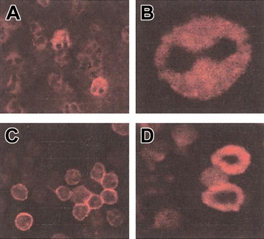 Figure 2. Staining of neutrophils and lymphocytes with a CD4-specific mAb. Immunofluorescence with CD4 mAb on permeabilized purified neutrophils (A-B) and PBMCs (C-D) from patient 1. Original magnifications × 63.