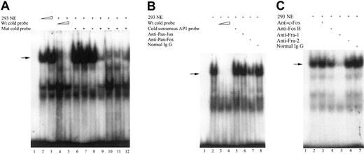 Figure 3. Binding of nuclear proteins from 293 cells to the FR-β promoter sequence – 338 nt to – 308 nt containing the repressor element. Nuclear extract from 293 cells and 32P-labeled probe (– 338 nt to – 308 nt) were used in the EMSA as described in “Materials and methods.” (A) Competition assay to map the protein binding site for the major and specific EMSA band (arrow) observed for the wild-type probe, – 338 nt to – 308 nt. Lanes 1 to 12, 30 000 cpm 32P-labeled probe; lane 2, 2.5 μg 293 cell nuclear extract; lanes 3 to 12, 5 μg 293 nuclear extract; lane 4, 50-fold excess wild-type unlabeled probe (– 338 nt to – 308 nt); lane 5, 100-fold excess wild-type unlabeled probe (– 338 nt to – 308 nt); and lanes 6 to 12, 100-fold unlabeled mutated probes, each with 2 consecutive nucleotides mutated from pyrimidine to purine or vice versa. The positions of the mutated nucleotides are indicated as follows in parentheses: lane 6, m(– 322 nt, – 321 nt); lane 7, m(– 320 nt, – 319 nt); lane 8, m(– 318 nt, – 317 nt); lane 9, m(– 316 nt, – 315 nt); lane 10, m(– 330 nt, – 329 nt); lane 11, m(– 328 nt, – 327 nt); and lane 12, m(– 325 nt, – 324 nt). (B) Effect of unlabeled consensus AP-1 probe and broadly reactive anti–AP-1 antibodies (anti–pan-Jun and anti–pan-Fos) on specific nuclear protein binding (arrow) to the labeled probe – 338 nt to – 308 nt. Lanes 1 to 8, 30 000 cpm 32P-labeled probe; lanes 2 to 8, 5 μg 293 cell nuclear extract; lane 3, 50-fold excess wild-type unlabeled probe; lane 4, 100-fold excess wild-type unlabeled probe; lane 5, 100-fold unlabeled 21-mer AP-1 consensus probe (sequence, CGCTTGATGACTCAGCCGGGAA); lane 6, 2.5 μg anti–pan-Jun antibody (broadly reactive with c-Jun, Jun B, and Jun D); lane 7, 2.5 μg anti–pan-Fos antibody (broadly reactive with c-Fos, FosB, Fra-1, and Fra-2); and lane 8, 2.5 μg normal rabbit IgG. (C) Effect of antibodies to specific Fos-family transcription factors on specific nuclear protein binding (arrow) to the labeled probe – 338 nt to – 308 nt. Lanes 1 to 7, 30 000 cpm 32P-labeled probes; lanes 2 to 7, 5 μg 293 nuclear extract; lane 3, 2.5 μg anti–c-Fos antibody; lane 4, 2.5 μg anti-FosB antibody; lane 5, 2.5 μg anti–Fra-1 antibody; lane 6, 2.5 μg anti–Fra-2 antibody; and lane 7, 2.5 μg normal rabbit IgG.