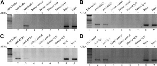 Figure 8. ChIP assays to detect the effect of ATRA on in vivo association of the nuclear receptors for retinoic acid or of Sp1 with the Sp1/EBS region in the FR-β promoter. KG-1 cells were treated with 1 μM ATRA for 24 hours and subjected to ChIP assays as described in “Materials and methods.” In all panels: lane 1, 50-bp DNA ladder; lanes 2, 4, 6, and 8, KG-1 cells treated with vehicle; lanes 3, 5, 7, and 9, KG-1 cells treated with ATRA; lanes 4 and 5, primers amplifying an irrelevant region in the FR-β gene used for PCR; lanes 6 and 7, normal rabbit IgG used for immunoprecipitation negative control; and lanes 8 and 9, input DNA used as template for PCR. (A) Effect of ATRA on the association of RARα with the Sp1/EBS region in the FR-β gene. Antibody specific for RARα was used in lanes 2 to 5. (B) Effect of ATRA on the association of RARβ with the Sp1/EBS region in the FR-β gene. Antibody specific for RARβ was used in lanes 2 to 5. (C) Effect of ATRA on the association of RARγ with the Sp1/EBS region in the FR-β gene. Antibody specific for RARγ was used in lanes 2 to 5. (D) Effect of ATRA on the association of Sp1 with the Sp1/EBS region in the FR-β gene. Antibody specific for Sp1 was used in lanes 2 to 5. Each experiment was repeated at least 4 times and concordant results were obtained.