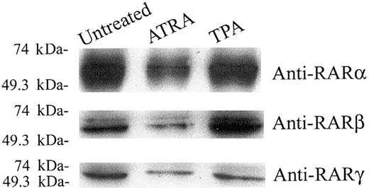 Figure 10. Western blot analysis of the ATRA effect on the expression levels of RARα, RARβ, and RARγ in KG-1 cells. Nuclear extracts were made from KG-1 cells, which were treated with ATRA (1 μM) or TPA (0.05 μM) for 5 days and subjected to Western blot analysis as described in “Materials and methods.” In each lane, 10 μg protein (for RARα) or 20 μg protein (for RARβ and RARγ) was loaded, and the blots were probed with antibody specific for RARα, RARβ,orRARγ.