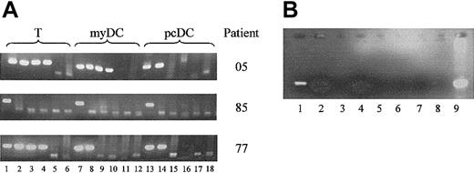 Figure 2. PCR analysis for provirus in DCs and T lymphocytes. (A) Analysis of HIV provirus load by limiting-dilution nested PCR on purified T lymphocytes, myDCs, and pcDCs. Results from 3 patients of 14 tested are shown. Lanes 1, 7, and 13 were amplified with 5000 cell equivalents of DNA; lanes 2, 8, and 14 were amplified with 1000 cell equivalents of DNA; lanes 3, 9, and 15 were amplified with 200 cell equivalents of DNA; lanes 4, 10, and 16 were amplified with 40 cell equivalents of DNA; lanes 5, 11, and 17 were amplified with 8 cell equivalents of DNA; and lanes 6, 12, and 18 were amplified with 1.6 cell equivalents of DNA. (B) DNA preparations from myDCs of 2 patients, (patient 1, lanes 1, 2, 5, 6; patient 2, lanes 3, 4, 7, 8) analyzed for integrated provirus. Lanes 1 through 4 employed Alu primers in the first-round reaction. In lanes 5 through 8, Alu primers were omitted from first-round reaction. Lanes 1, 3, 5, and 7 were amplified with 5000 cell equivalents of DNA. Lanes 2, 4, 6, and 8 were amplified with 1000 cell equivalents of DNA. Lane 9 is an unnested PCR product obtained using the second-round LTR primers and DNA extracted from H9 cells infected with HIV-1 IIIB.