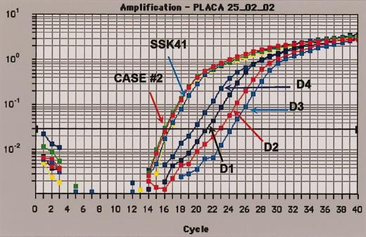 Figure 4. Quantification of MALT1 gene expression by real-time PCR. Logarithmic plot of fluorescence signal (y-axis) versus number of PCR cycles (x-axis). Samples D1, D2, D3, and D4 represent results obtained with RNA extracted from peripheral blood mononuclear cells from 4 healthy donor samples. MALT1 curves in duplicate for case 2 (red and green lines) and SSK-41 cell line (blue and yellow lines), all with similar MALT1 expression levels with respect to healthy donors, are shown.