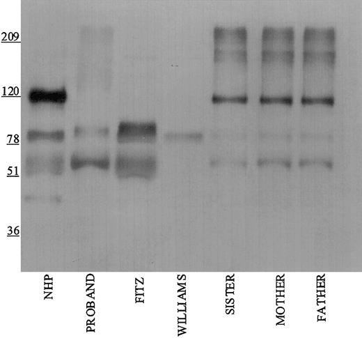 Figure 1. Immunoblotting of plasma with polyclonal antibody directed to the light chain of HK. Pooled normal human plasma (NHP) and plasmas from the family members were diluted 1:20 in TBS prior to the addition of an equal volume of sample buffer. Plasmas from the propositus, Fitzgerald (FITZ), and Williams were diluted 1:10. All samples were reduced with 2% β-mercaptoethanol and boiling prior to being applied to a 7% SDS-PAGE. After electrophoresis, the samples were electroblotted onto nitrocellulose and incubated with polyclonal antibody AHMWK3 at 1:500 in Blotto.23 Bound antibody was detected by peroxidase-conjugated secondary antibody to goat immunoglobulin G (IgG) followed by chemiluminescence. The figure is a representative immunoblot of 3. In this and subsequent figures, the numbers on the left represent molecular mass standards in kilodaltons.