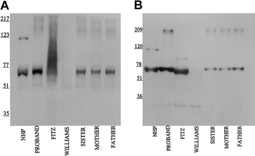 Figure 2. Immunoblot of plasma with monoclonal antibodies HKH 14 and HKH 15. Pooled normal human plasma (NHP), plasmas from the family members (1:20 in TBS), and plasmas from the propositus, Fitzgerald (FITZ), and Williams (1:10) were electrophoresed on a reducing 7% SDS-PAGE, followed by electroblotting onto nitrocellulose and incubation with monoclonal antibodies HKH14 (panel A) and HKH15 (panel B) at 2 μg/mL in Blotto.23 Bound antibody was detected by peroxidaseconjugated secondary antibody to mouse IgG followed by chemiluminescence.