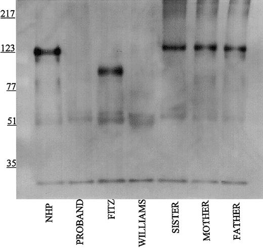 Figure 3. Immunoblot of plasma with monoclonal antibody HKL13. Samples were processed as detailed in the legend to Figure 1 except that monoclonal antibody HKL13 was used at 2 μg/mL.