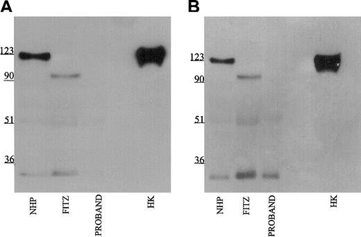 Figure 4. Immunoblot of plasma with monoclonal antibodies HKL12 and HKL14. Samples were processed as detailed in the legend to Figure 1 except that monoclonal antibodies HKL12 (panel A) and HKL14 (panel B) were used at 2 μg/mL.