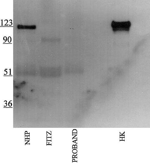 Figure 5. Immunoblot of plasma using antibody AHKH20. Samples were processed as detailed in the legend to Figure 1 except that rabbit antipeptide antibody AHKH20 was used at a 1:500 dilution. Bound antibody was detected by peroxidaseconjugated secondary antibody to rabbit IgG followed by chemiluminescence.
