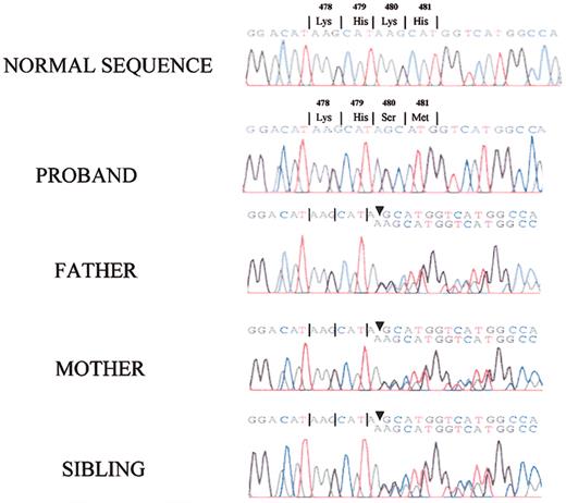 Figure 7. Identification of a base pair deletion within exon 10 of the HK gene. The amplified PCR fragments of exon 10 from normal human, the propositus', and all family members' DNA underwent direct nucleotide sequencing. The propositus exhibited a homozygous base pair deletion of an adenine at nucleotide position 367 in exon 10 (corresponding to position 1492 of the full-length mRNA and position 480 of the mature protein). All family members were heterozygous for the same defect in the PCR of their amplified DNA.