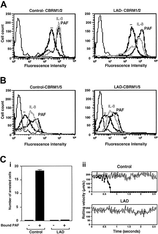 Figure 2. Normal chemoattractant activation of Mac-1 in LAD neutrophils is insufficient to trigger adhesion to Mac-1 ligand. (A) PAF- or IL-8–triggered up-regulation of Mac-1 on surface of control or LAD neutrophils. Cell surface Mac-1 on intact or agonist-treated neutrophils was assessed by FACS staining using the Mac-1 specific mAb CBRM1/2. (B) Induction of the activation neoepitope CBRM1/5 on surface Mac-1 of intact and chemoattractant-stimulated neutrophils. In panels A-B, neutrophils were stimulated with either 200 ng/mL IL-8 or 100 nM PAF as outlined in “Materials and methods.” Background staining is indicated by the thin black lines. (C) Arrest of PAF-stimulated neutrophils on fibrinogen (coated at 10 μg/mL) under low physiological shear flow. (i) Control or LAD neutrophils activated by PAF identically as in panels A-B were immediately perfused over fibrinogen at a shear stress of 0.5 dyne/cm.2 The number of leukocytes stably arrested on the substrate upon capture was determined. No transient tethers were observed in any of the indicated settings. Results are given as mean ± range of determinations in 2 fields of view. (ii) Instantaneous velocity profile (upper panel, ▪) of a PAF-stimulated control neutrophil tethered and arrested on the fibrinogen-coated substrate deduced from computerized cell tracking analysis.47 Velocity profile of a resting control neutrophil (⬢) is shown for comparison. Velocity profiles of both PAF-stimulated and resting neutrophils from the LAD patient (lower panel, ▪ and ⬢, respectively) show no velocity drops, suggesting lack of transient adhesive tethers. Profiles are shown for representative neutrophils.