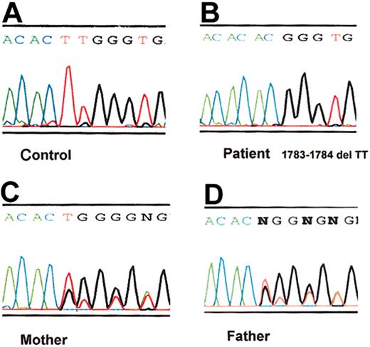 Figure 2. ADAMTS13 mutation in the patient with congenital TTP. DNA sequence chromatograms corresponding to ADAMTS13 exon 15 are shown here for PCR-amplified genomic DNA from a healthy control (A), the patient (B), the patient's mother (C), and the patient's father (D). The patient DNA exhibits a homozygous 2-nucleotide (TT) deletion at the end of exon 15 (corresponding to position 1783-1784 of the ADAMTS13 cDNA), resulting in a frameshift after His594, followed by a predicted 18–amino acid extension and premature termination. The DNA chromatograms from both parents demonstrate superimposed normal and deletion allele sequences, indicating that they are heterozygous for this mutation.