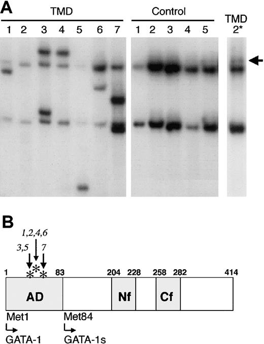 Figure 1. Mutation of GATA1 in TMD. (A) SSCP analysis of the second exon of GATA1 revealed the presence of mutated conformational GATA1 alleles in DNA from each of 7 TMD patients. In contrast, GATA1 mutations were not detected in DNAs from 5 healthy individuals. A longer exposure of the SSCP gel revealed a mutant allele in DNA from TMD-2 (arrow, TMD-2* lane). (B) Schematic illustration of the functional domains of GATA-1. AD indicates activation domain; Nf, N terminal zinc finger; Cf, C-terminal zinc finger. The asterisks indicate the positions of the mutations in the 7 individuals with TMD (numbered 1 through 7). Met84 is an alternative translation initiation codon, which leads to the production of GATA-1s.