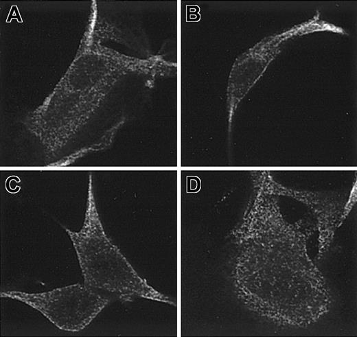 Figure 4. Distribution of the normal and mutant CNO proteins in stably transfected fibroblasts. C57Bl/6J fibroblasts were transfected with pCMV-Tag4 FLAG expressing the normal (A-B) and mutant (C-D) CNO proteins and stained with anti-FLAG antibody. No disruption of the overall distribution of the mutant CNO protein is discernable. Original magnification × 1000.