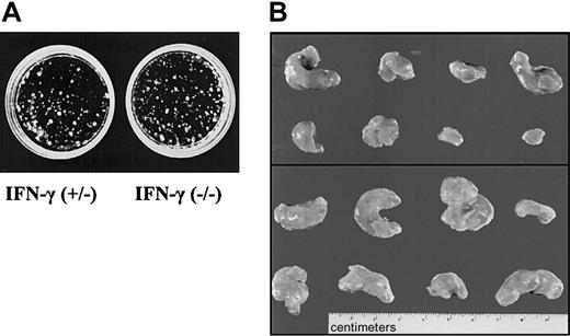 Figure 7. IFN-γ deficiency reflects the phenotype of Jak1 deficiency. (A) Colony formation of Ab-MuLV–transformed fetal liver cells from IFN-γ(+/–) and IFN-γ(–/–) embryos. No differences were observed. One representative experiment of each genotype is shown. (B) Tumor formation in SCID mice. A total of 1 × 106 transformed cells were injected. The top panel shows the 8 tumors that developed upon injection of IFN-γ(+/–) cells. The bottom panel depicts 8 of the 13 tumors that developed out of IFN-γ(–/–) cells.