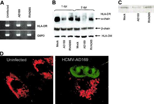 Figure 5. HCMV specifically affects the HLA-DR α-chain in infected cells. Fibroblasts were examined for the presence of HLA-DR mRNA in uninfected and HCMV-infected cells at 1 day after infection, using an RT-PCR assay. The transcription of HLA-DR in HCMV-AD169, RVAD65-infected fibroblasts, or uninfected cells is shown in panel A (n = 5). To analyze whether HCMV induces degradation of HLA-DR molecules, immunoprecipitation experiments were performed. The presence of HLA-DM or the HLA-DR α-or β-chain is shown in panel B at 1 and 2 days after infection (n = 3). The effect on newly synthesized HLA-DR α molecules was examined in cells after 4 hours of infection and 2 hours chase in mock-infected, AD169-, or RVAD65-infected cells (C). The distribution of HLA-DR and the expression of pp65 were examined by confocal microscopy. The HLA-DR expression in mock-infected cells and HCMV-infected cells at 1 day after infection is shown in panel D. The HCMV protein pp65 was present in the nucleus in HCMV-infected cells (D) at 1 day after infection. Original magnification, × 40.
