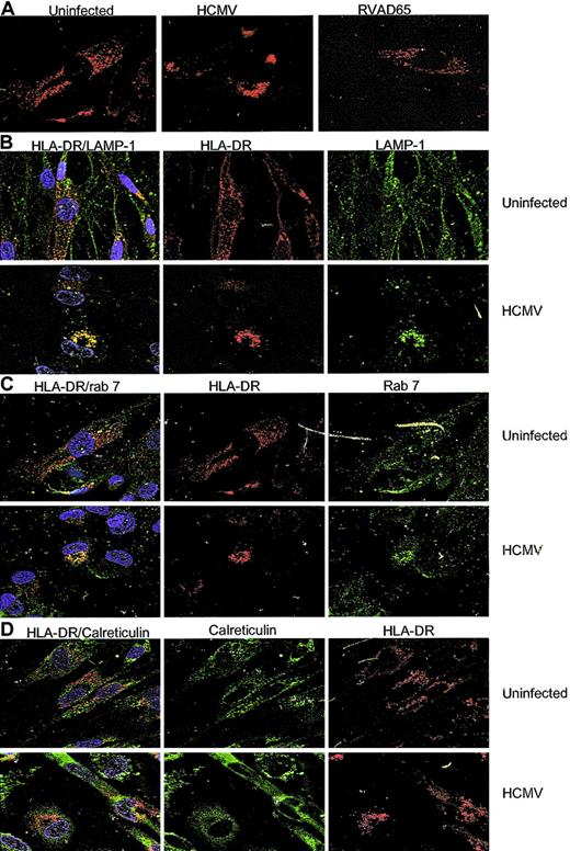 Figure 6. The transportation of HLA-DR is blocked in HCMV-infected cells. Confocal microscopy analysis was performed to examine the distribution of HLA-DR in HCMV, RVAD65-infected, and mock-infected cells at 1 day after infection. The staining pattern of HLA-DR is shown in panel A. Colocalization studies of HLA-DR (red) with LAMP-1 (green), rab 7 (green), or calreticulin (green) in uninfected and HCMV-infected cells is shown in panels B, C, and D, respectively. Original magnification, × 40.