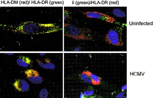 Figure 7. HLA-DM accumulates in vacuoles near the nucleus in HCMV-infected cells. The distribution of HLA-DM (red) and Ii (green), and its colocalization with HLA-DR was examined in mock-infected and HCMV-infected cells at 1 day after infection by confocal microscopy. Original magnification, × 40.