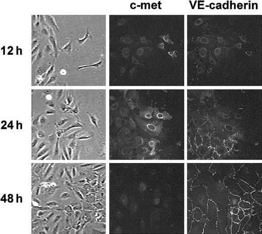 Figure 2. c-met and VE-cadherin are inversely regulated at the healing edge in wound assay. Confluent HUVEC monolayers were damaged by scratching a linear wound and incubated in regular medium. At the indicated times cultures were fixed and processed for double-staining immunofluorescence analysis of c-met and VE-cadherin expression at the border of the wounded area. Data are representative of 3 experiments. Images in far left column are brightfield images. For all images in Figure 2: original magnification, × 400.