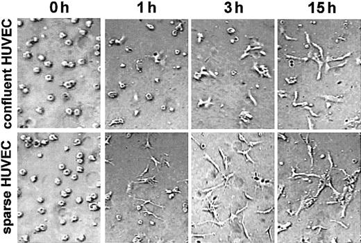 Figure 6. Sparse HUVECs undergo morphogenesis more rapidly in 3-dimensional collagen culture. HUVECs isolated from the same cord and grown as confluent or sparse monolayers were trypsinized and seeded in a 3-dimensional collagen gel. Photographs were taken at 0, 1, 3, and 15 hours using phase contrast optics. Data are representative of 3 experiments. For all images in Figure 6: original magnification, × 200.