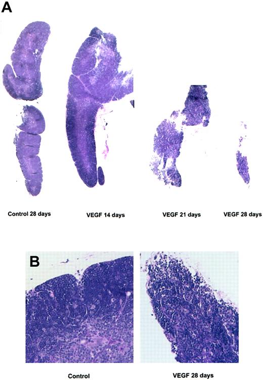 Figure 2. Photomicrograph of thymus sections stained with H&E. Balb/c mice (6 to 8 weeks old) were treated with a continuous infusion of VEGF (50 ng/h). Mice were killed on days 14, 21, and 28. (A) Photomicrographs are representative of 3 or more independent experiments (original magnification, × 20). (B) Control and VEGF-treated thymus sections following 28 days of infusion from panel A at higher magnification (× 400).