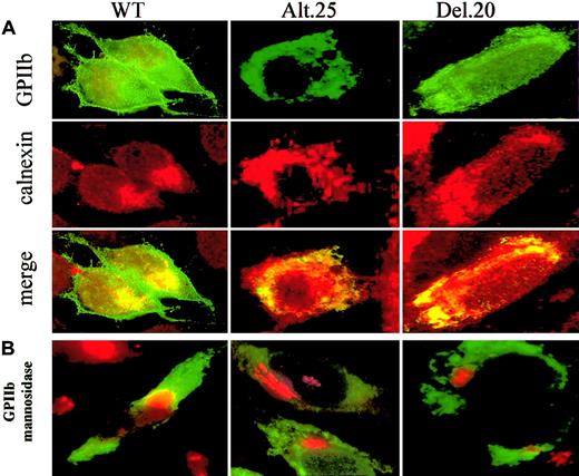 Figure 7. Cellular localization of GPIIb by immunofluorescence staining. (A) Transfected cells were stained simultaneously with SZ22 against GPIIb (green) and calnexin, an ER marker (red). The yellow color demonstrates colocalization of GPIIb with an organelle marker (merger of red and green). WT GPIIb is localized in the plasma membrane as well as the ER, whereas alt.25 and del.20 GPIIb are located only in the ER. (B) Transfected cells were stained simultaneously with SZ22 against GPIIb (green) and rabbit polyclonal antibodies against mannosidase II (red). Colocalization of GPIIb and mannosidase II, a Golgi marker, is seen in cells with WT GPIIb but not in cells harboring GPIIb alt.25 and del.20. Original magnification, × 1000.
