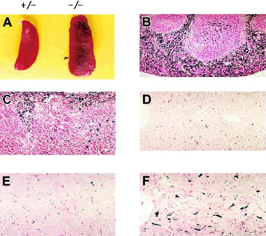 Figure 2. Morphologic phenotypes of Prx II–/– mice. (A) Splenomegaly in Prx II–/– mice and heterozygous mice at 8 weeks of age. (B-C) Prussian blue–stained sections of spleen from wild-type (B) and Prx II–/– (C) mice. Red pulp was increased in Prx II–/– mice. (D-F) Prussian blue–stained sections of liver from splenectomized wild-type mice (D), unsplenectomized Prx II–/– mice (E), and splenectomized Prx II–/– mice (F). Stained iron was markedly increased in the livers of splenectomized Prx II–/– mice but scant in the livers of unsplectomized Prx II–/– mice and absent from the livers of wild-type mice. Original magnifications: panels B-C, × 200; panels D-F, × 400.