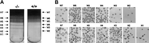 Figure 4. Separation of dense cells and their morphology. (A) RBCs were separated with an arabinogalactan density discontinuous gradient into 7 bands (H1 to H7) using blood from Prx II–/– mice (left) and 6 bands (W2 to W7) using blood from wild-type mice (right). (B) Abnormally shaped RBCs were found in all fractions (H1 to H7) from the Prx II–/– mice. Spherocytes (Sp), schistocytes (Sc), burr cells (B), and polychromatophilic macrocytes (P) are indicated.
