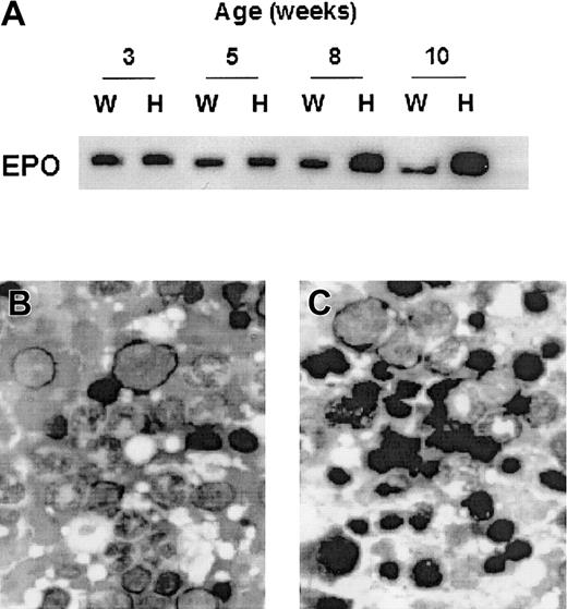 Figure 7. EPO expression in serum and the ratio of erythroid to myeloid precursors in bone marrow. (A) Western blot analysis of EPO in serum. Serum was collected at the indicated times from the peripheral blood of Prx II+/+ and Prx II–/– mice. Each fraction was separated by 12% SDS-PAGE and Western blot hybridized with antierythropoietin antibody. “W” and “H” indicate samples from the wild-type and Prx II–/– mice, respectively. (B-C) Bone marrow smears in wild-type (B) and Prx II–/– mice (C). Dark black cells indicate normoblasts. Original magnification, × 1000.