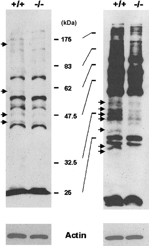 Figure 8. Detection of proteins containing cysteine residues sensitive to ROS. The membrane proteins labeled with BIAM were subjected to either a 10% SDS-PAGE (left) or a 12% SDS-PAGE (right) and detected by enhanced chemiluminescence (ECL) after blotting with HRP-conjugated streptavidin. Arrows indicate proteins with reduced BIAM labeling in Prx II–/– mice compared with wild-type mice. Actin was used as an internal control.