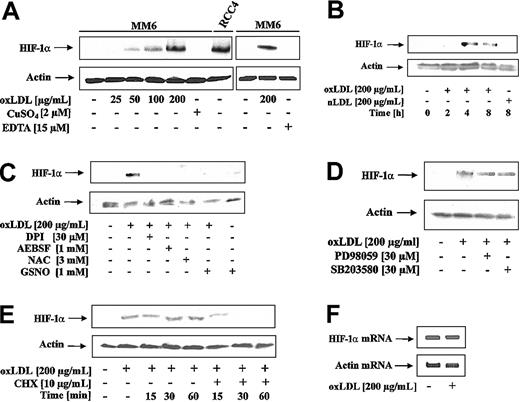Figure 1. HIF-1α accumulation in response to oxLDL. (A) MM6 cells were treated with increasing concentrations of oxLDL for 8 hours. For control reasons, 2 μM CuSO4, 15 μM EDTA (ethylenediaminetetraacetic acid), and a lysate of RCC4 cells were processed in parallel. (B) MM6 cells were time-dependently stimulated with 200 μg/mL oxLDL or nLDL. (C) MM6 cells were pretreated with 3 mM NAC, 30 μM DPI, and 1 mM 4-(2-aminoethyl)-benzenesulfonyl fluoride (AEBSF) for 2 hours, followed by stimulation with 200 μg/mL oxLDL for 8 hours. S-nitrosoglutathione (GSNO; 1 mM) was supplied together with oxLDL for 8 hours. (D) Cells were pretreated with 30 μM PD98059 or 30 μM SB203580 for 2 hours, following by stimulation with 200 μM oxLDL for 8 hours. (E) HIF-1α expression was induced by exposing MM6 cells to 200 μg/mL oxLDL for 8 hours. Cycloheximide (CHX) at a final concentration of 10 μg/mL was added for the times indicated (15-60 minutes). (F) Cells were treated with 200 μg/mL oxLDL for 5 hours, and HIF-1α mRNA was followed by RT-PCR analysis as described. All experiments were performed at least 3 times and representative data are shown. HIF-1α protein was detected by Western blot analysis as outlined in “Study design.”