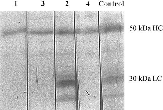 Figure 3. Analysis of binding of patients' IgG to factor XIa by Western blotting. Factor XIa was electrophoresed on 8% SDS-PAGE (0.2 μg per lane) under reducing conditions, followed by transfer to a PVDF membrane. Each lane was then incubated with the IgG of the patients (lanes 1-4), and one lane was incubated with goat antihuman factor XI IgG (control). The lanes were then processed as described in “Patients, materials, and methods.” The 50-kDa heavy chain (HC) and the 30-kDa light chain (LC) are depicted. Normal control IgG and IgG purified from a type II homozygote with no inhibitor failed to recognize factor XI (data not shown).
