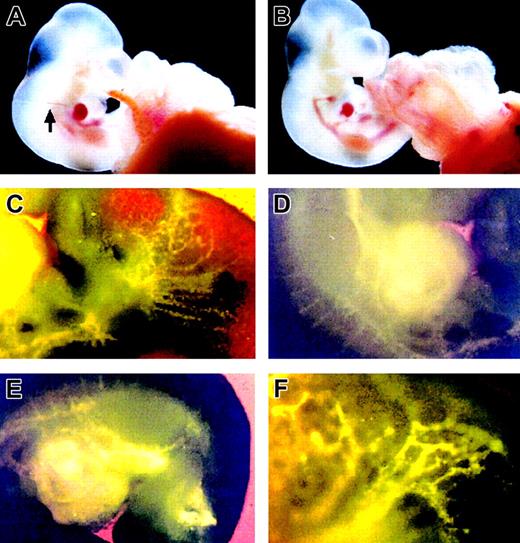Figure 1. Appearance of a mouse embryo inoculated with Ac-LDL-DiI at 10 dpc after 12 hours' whole-embryo culture. (A) An embryo before culture was inoculated with Ac-LDL-DiI into the heart. Arrow points out the injection needle. (B) An embryo after 12 hours' culture. (C-E) Vessel labeling after Ac-LDL-DiI staining 1 hour after inoculation observed under ultraviolet transillumination with the appropriate filter. (C) Region of the branchial arches. (D) Region of the heart. Note the delicate staining of the segmental arteries. (E) Truncal region. (F) magnified view of the upper part of the embryo.