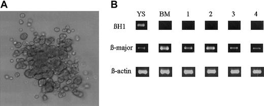 Figure 5. Erythroid colony formation from the DiI+ cells. (A) Appearance of an erythroid burst formed from the sorted DiI+ cells. Original magnification, × 100. (B) RT-PCR analysis for the expression of βH1 and β-major globin gene by the sorted DiI+ cells (lane 1) and the erythroid bursts formed from the DiI+ cells (lanes 2 to 4). YS indicates 8.5-dpc YS cells; BM, adult bone marrow cells.