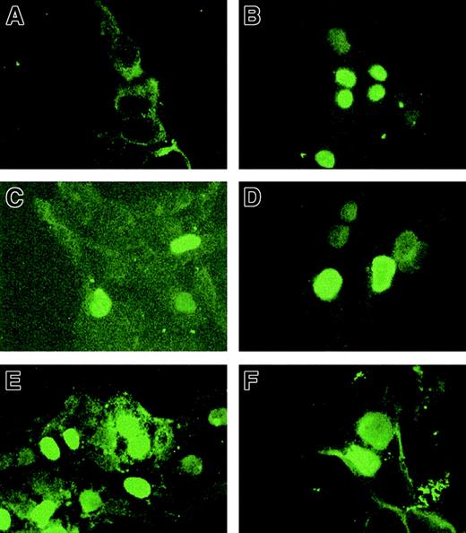 Figure 6. HOX11 mutants are expressed in nuclei of transfected cells. Transiently transfected HEK 293T cells were cultured on fibronectin-coated coverslips and fixed in 3.7% formaldehyde. Immunohistochemical analysis was performed using 10 μg/mL anti-HOX11 polyclonal antibody and 5 μg/mL fluorescein-linked goat–anti-rabbit secondary antibody and visualized using a fluorescence microscope. Original magnification, × 100. (A) pcDNA3 vector, (B) HOX11 WT, (C) HOX11 H3d, (D) HOX11 M5, (E) HOX11 Thr47Ile, (F) HOX11 Lys55Gln.