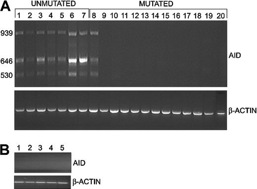 Figure 1. Expression of AID assessed by RT-PCR assays. (A) Expression of AID in CLL cells. High levels of wild-type AID (646 bp) and 2 splice variants (939 bp and 530 bp) were detected in 7 of 7 cases of CLL with unmutated VH genes (lanes 1-7) but only 1 of 13 cases with mutated VH genes (lanes 8-20). The amount of cDNA amplified for each sample was comparable, as shown by the β-actin signal. (B) Expression of AID in NBCs. In contrast, wild-type AID and splice variants were not detected in 5 NBC samples using our standard conditions.