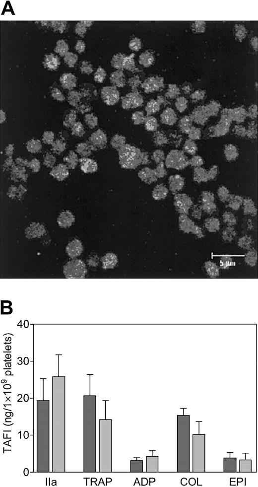 Figure 1. Identification of TAFI in platelets. TAFI was identified in cytospins of gel-filtered platelets by immunofluorescence confocal microscopy (A), using a monoclonal antibody against TAFI (9H10) and an FITC-labeled secondary antibody. The scale bar represents 5 μm. TAFI secretion by stimulated platelets (B). Gel-filtered platelets (2.8 × 107) were incubated with a high (dark bars) or a low (light bars) concentration of platelet agonist for 15 minutes at 37°C, and the secretion of TAFI was determined by ELISA. The agonists used were thrombin (IIa; 5 or 0.5 U/mL), thrombin receptor–activating peptide (TRAP; 100 or 10 μM), adenosine 5′-diphosphate (ADP; 20 or 2 μM), collagen (COL; 10 or 1 μg/mL), and epinephrine (EPI; 10 or 1 μM). Each bar represents the mean ± SEM of 5 independent experiments using different donors.