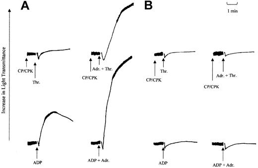 Figure 5. Effect of adrenaline on thrombin and ADP-induced aggregation. The effect of adrenaline on ADP- and thrombin-induced aggregation in washed platelets prepared from normal (A) or patient (B) blood. Washed platelets were incubated with adrenaline (3 μM) or saline just prior to the addition of either ADP (5 μM) or thrombin (0.025 U/mL). In experiments with thrombin, a combination of creatinine phosphate (CP; 40 mM) and creatine phosphokinase (CPK; 100 U/mL) was added 1 minute prior to agonist addition. Arrows indicate points of induction. The results shown are representative of 2 other independent experiments.